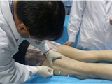 法国留学生参观及体验甘肃省中医院风湿骨病科中医特色治疗技术