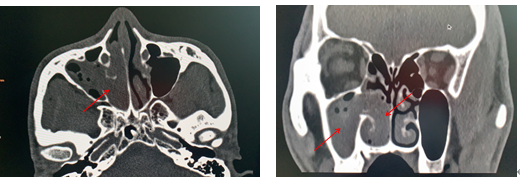 202009231115127715.png 202009231115127715.png