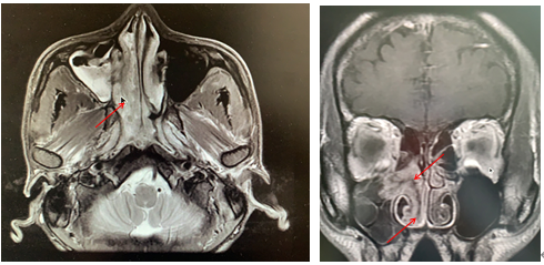 202009231115373621.png 202009231115373621.png