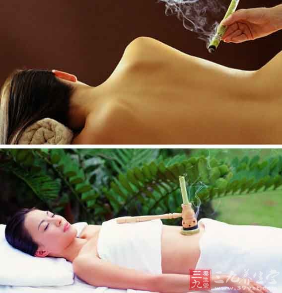 艾灸